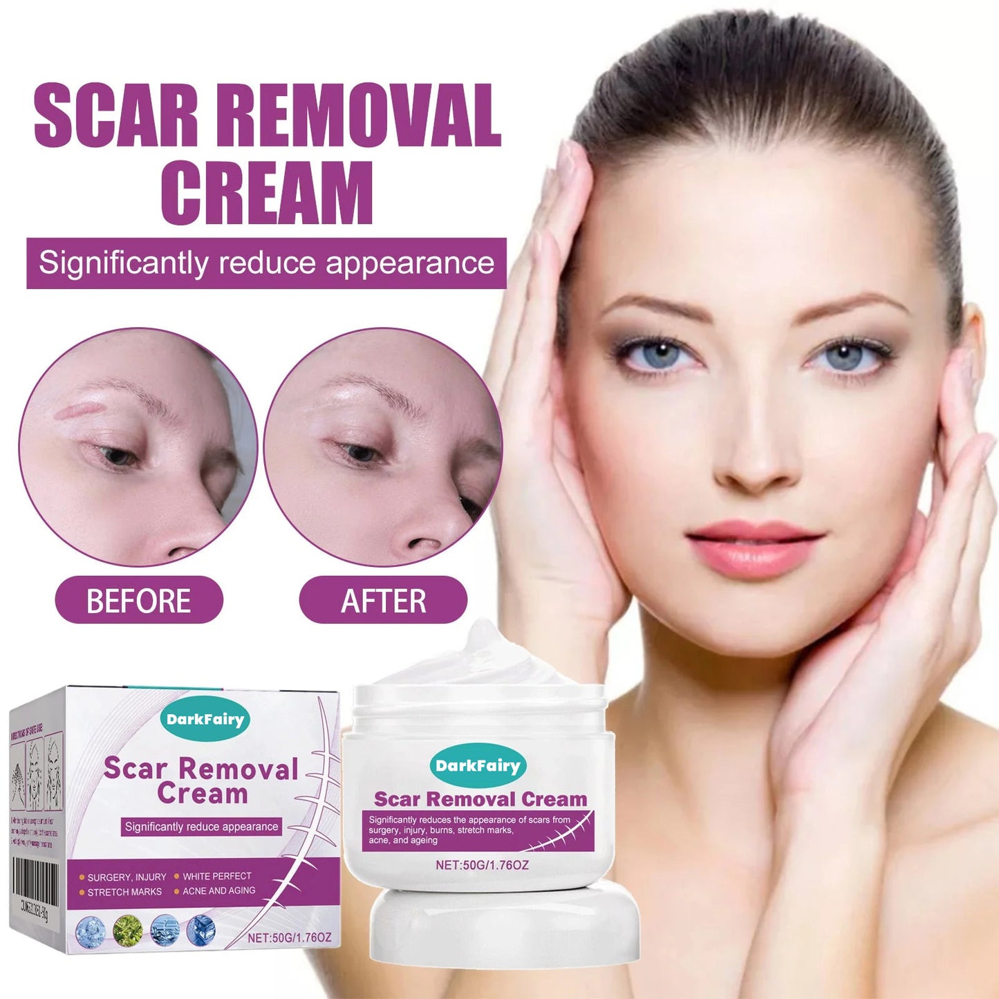 💥Hot-selling Dark Fairy Scar Cream✨A variety of packages for you to choose from! 💥Plus 7-day return and exchange service!