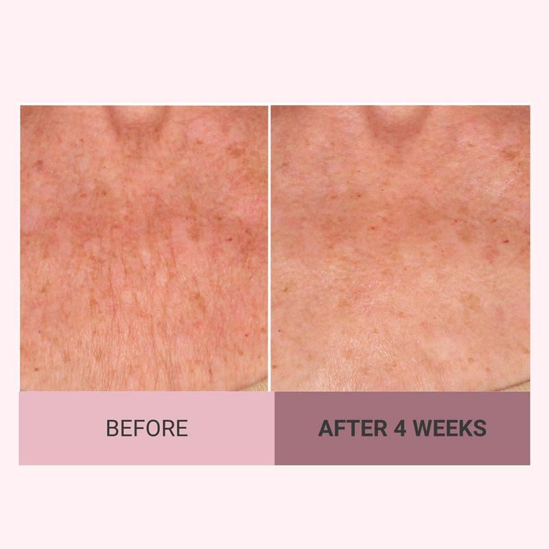 ✨Champagne Beaute Lift Firming Body Cream - For Firmer, Smoother, Radiant Skin! 🌟