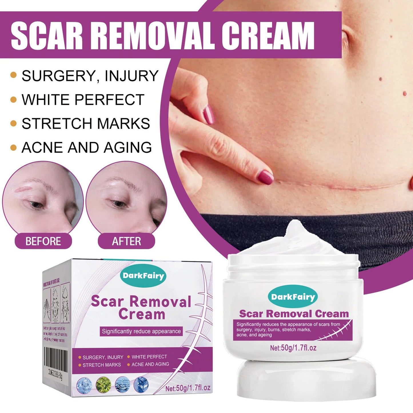 💥Hot-selling Dark Fairy Scar Cream✨A variety of packages for you to choose from! 💥Plus 7-day return and exchange service!