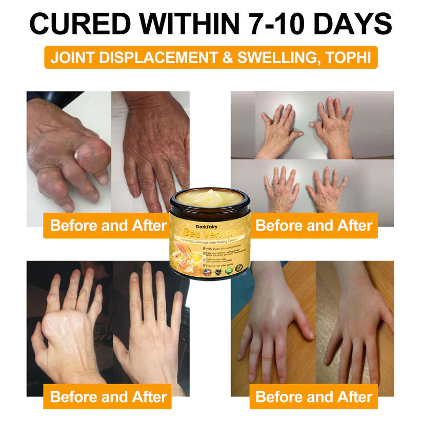 DarkFairy® Bee Venom Advanced Joint and Bone Healing Cream