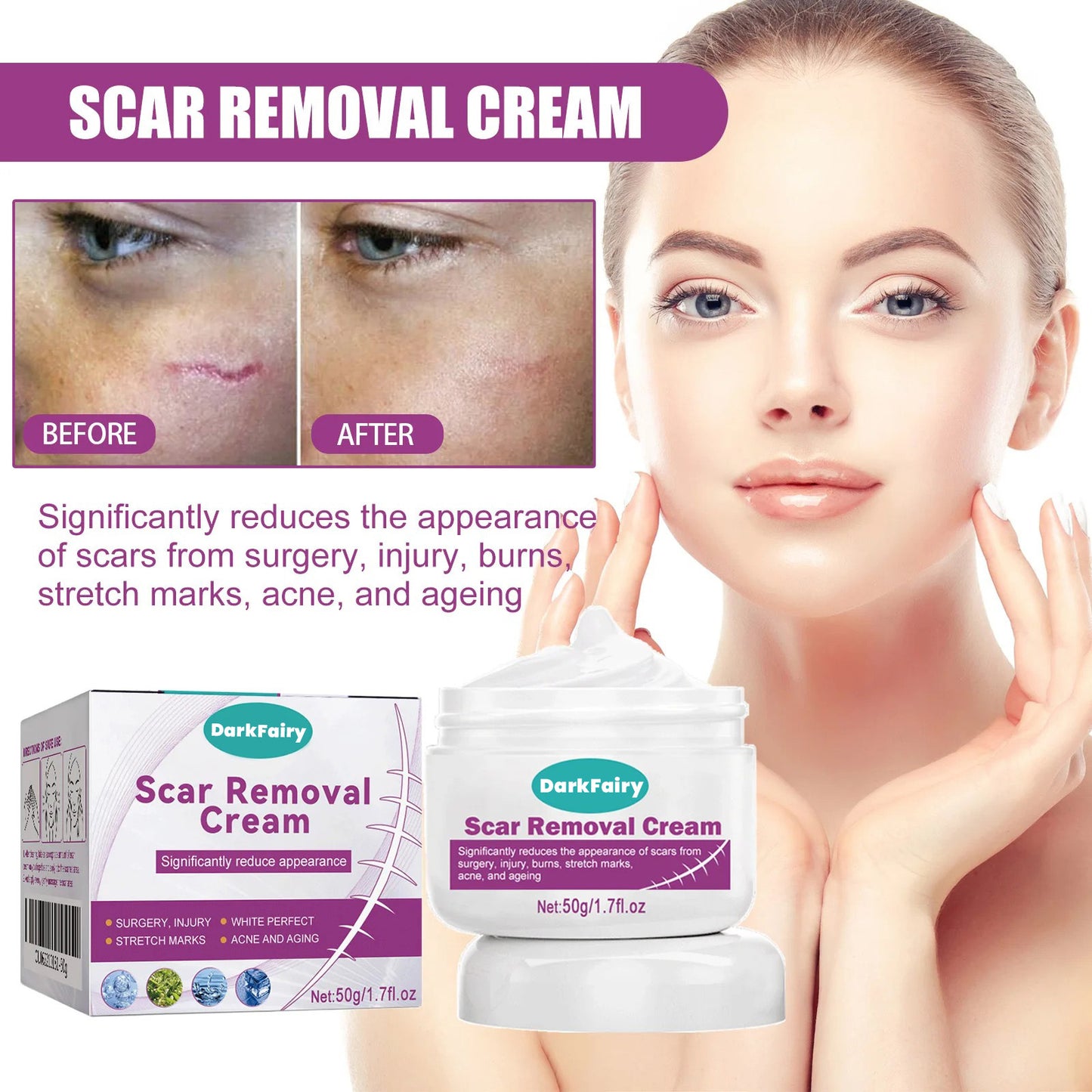 💥Hot-selling Dark Fairy Scar Cream✨A variety of packages for you to choose from! 💥Plus 7-day return and exchange service!