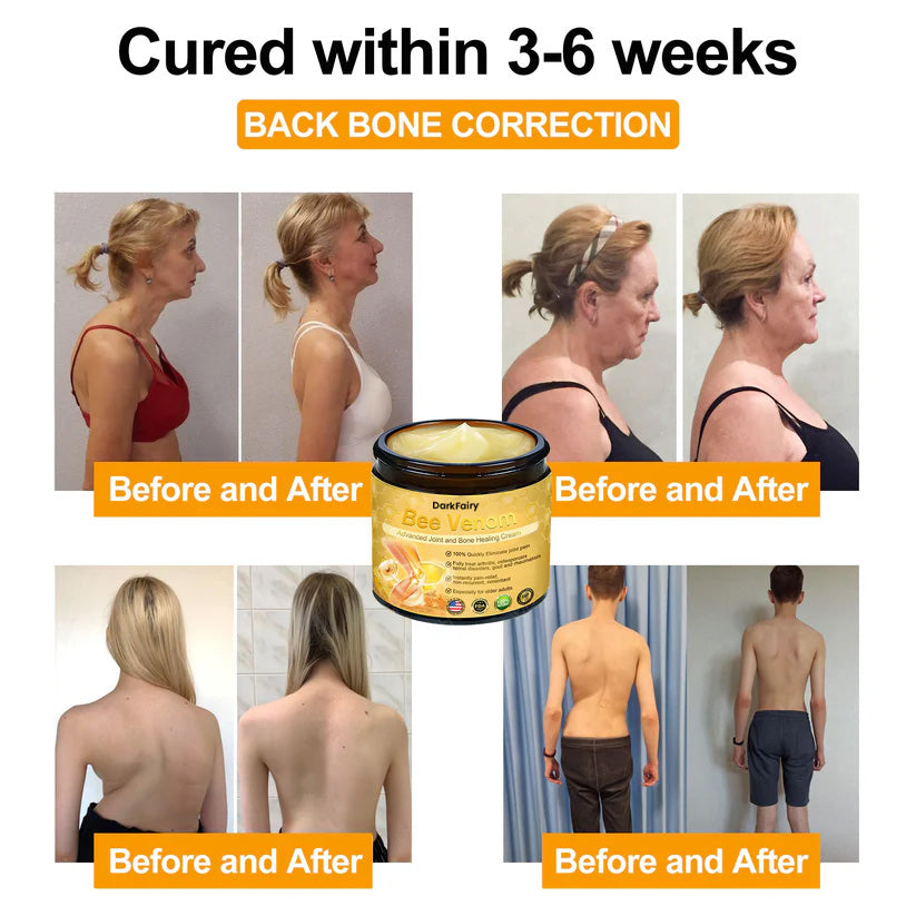 DarkFairy® Bee Venom Advanced Joint and Bone Healing Cream