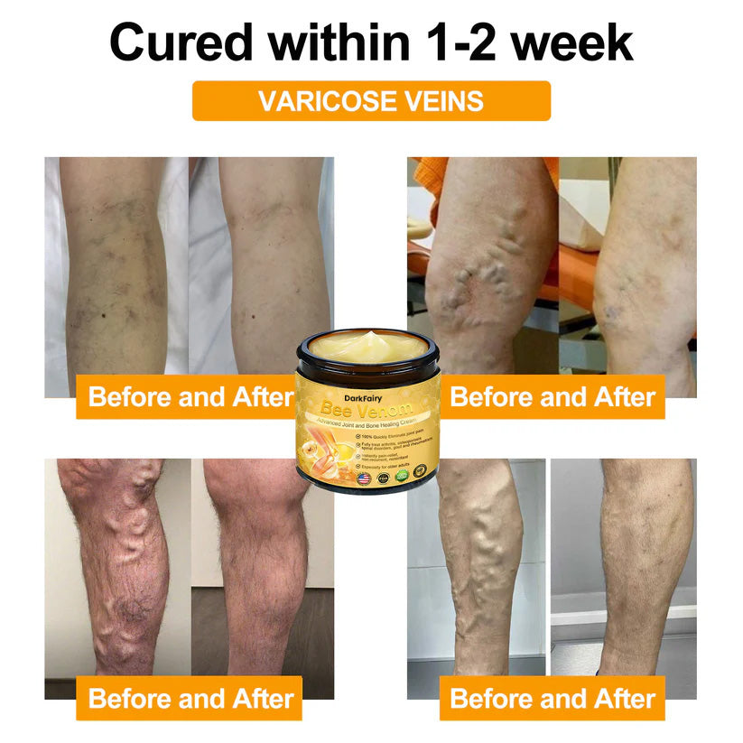 DarkFairy® Bee Venom Advanced Joint and Bone Healing Cream