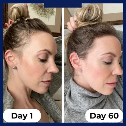 DarkFairy HairRevive™ Roll on System