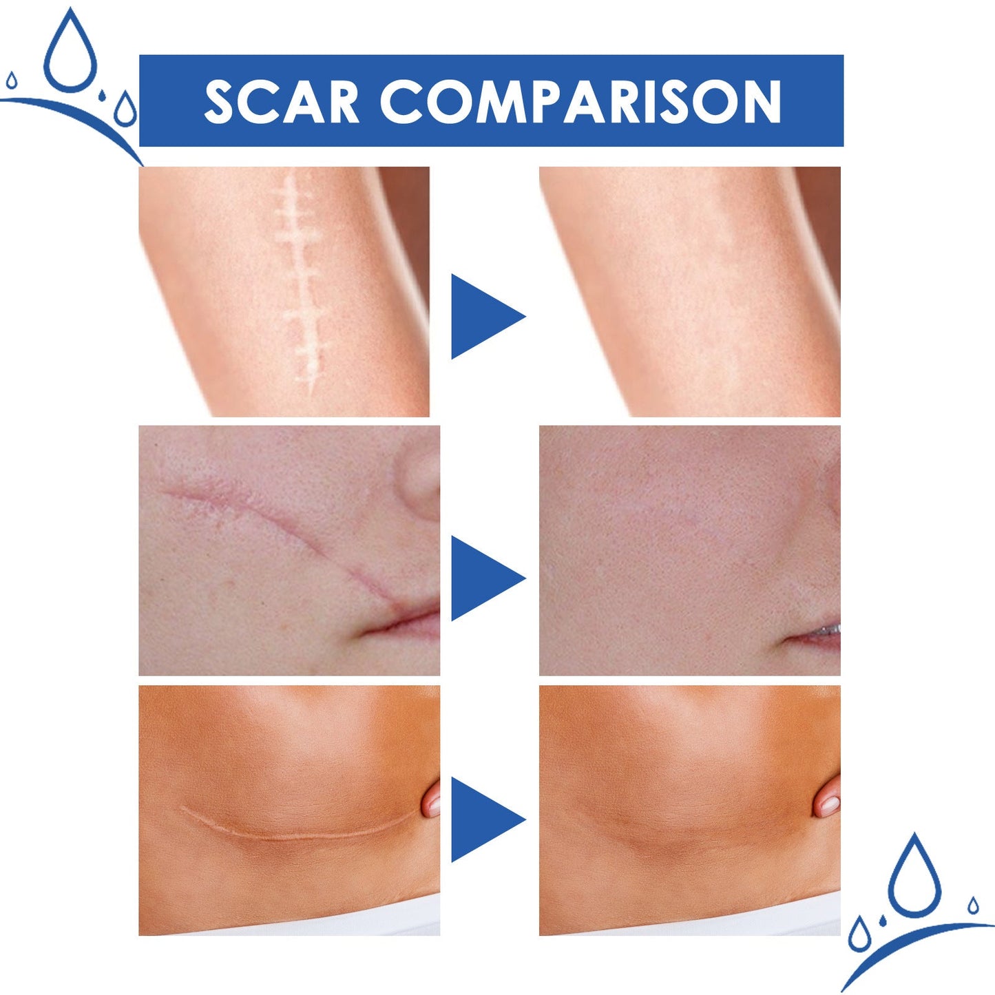 Ugly scars ??? 🔥 50% off repair cream to smooth out blemishes! 🔥