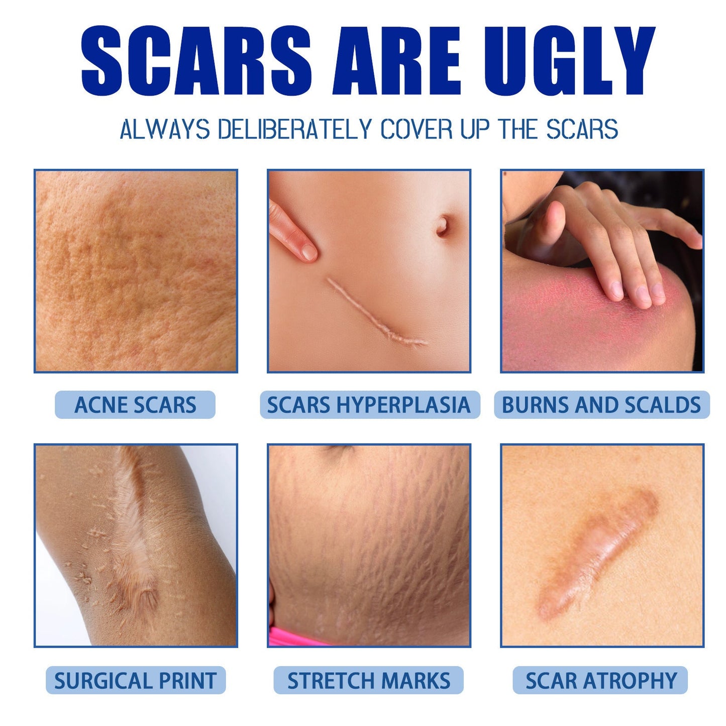 Ugly scars ??? 🔥 50% off repair cream to smooth out blemishes! 🔥