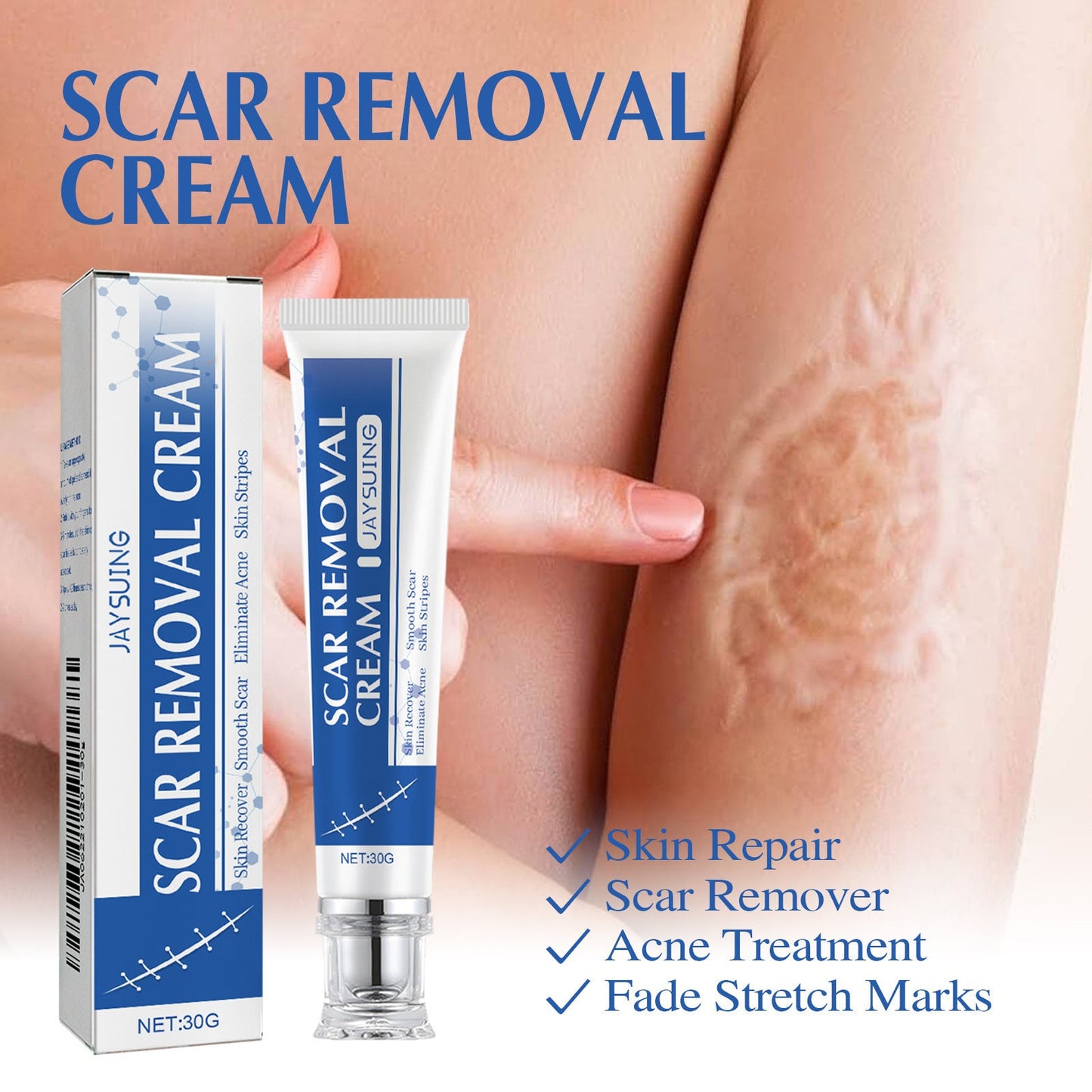Ugly scars ??? 🔥 50% off repair cream to smooth out blemishes! 🔥