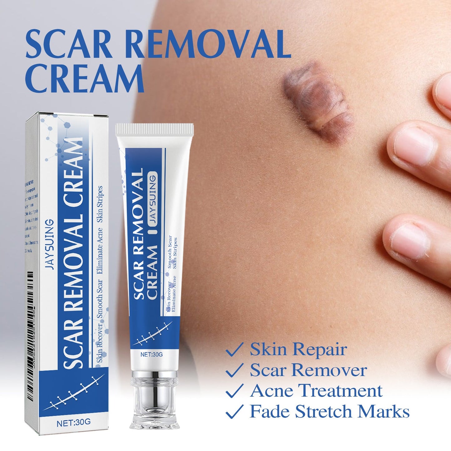 Ugly scars ??? 🔥 50% off repair cream to smooth out blemishes! 🔥
