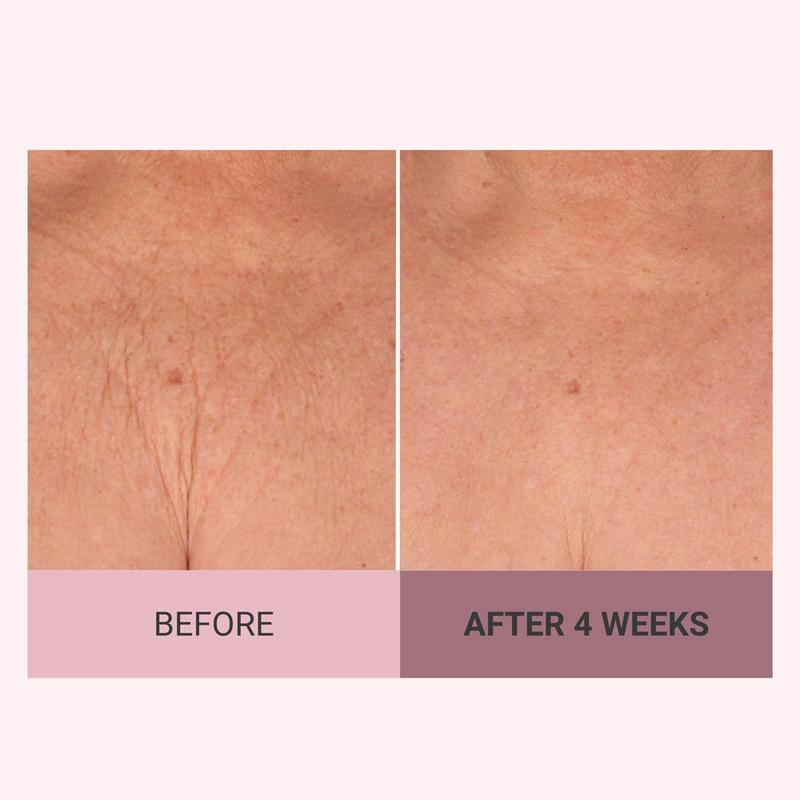 ✨Champagne Beaute Lift Firming Body Cream - For Firmer, Smoother, Radiant Skin! 🌟