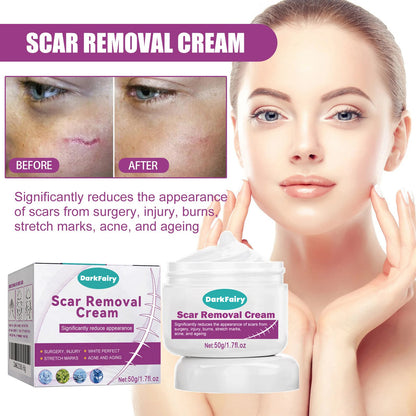 💥Hot-selling Dark Fairy Scar Cream✨A variety of packages for you to choose from! 💥Plus 7-day return and exchange service!