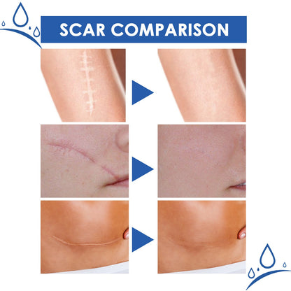 Ugly scars ？？？ 🔥 50% off repair cream to smooth out blemishes! 🔥