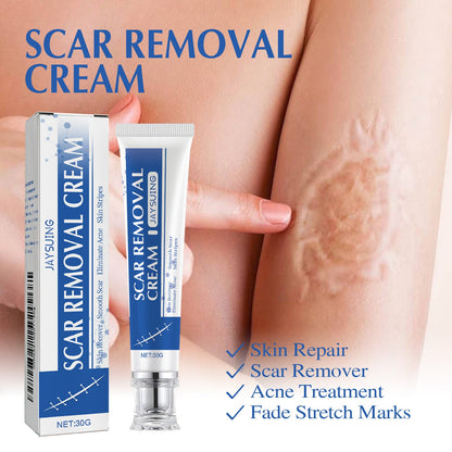 Ugly scars ？？？ 🔥 50% off repair cream to smooth out blemishes! 🔥